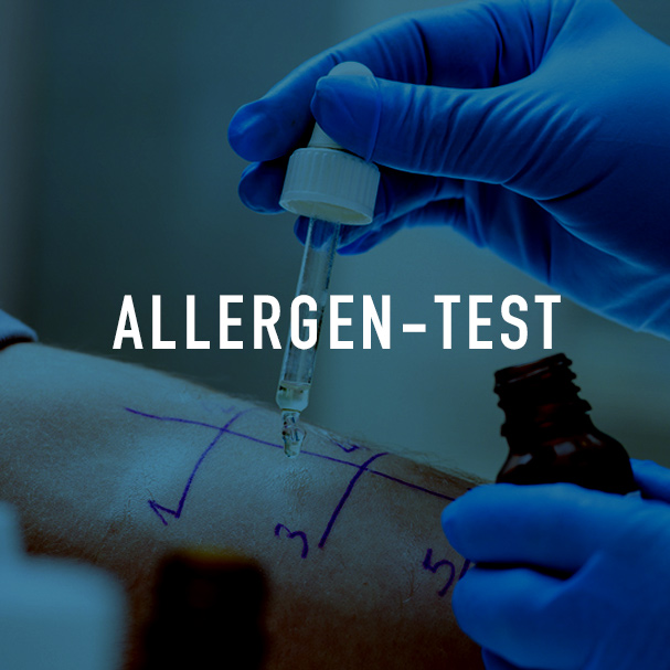 Fooddes alergen test